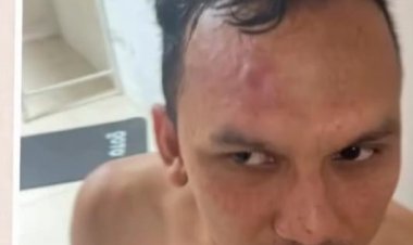 Kapten PSMS Ditonjok, Laga Persiraja vs PSMS Berakhir Ricuh